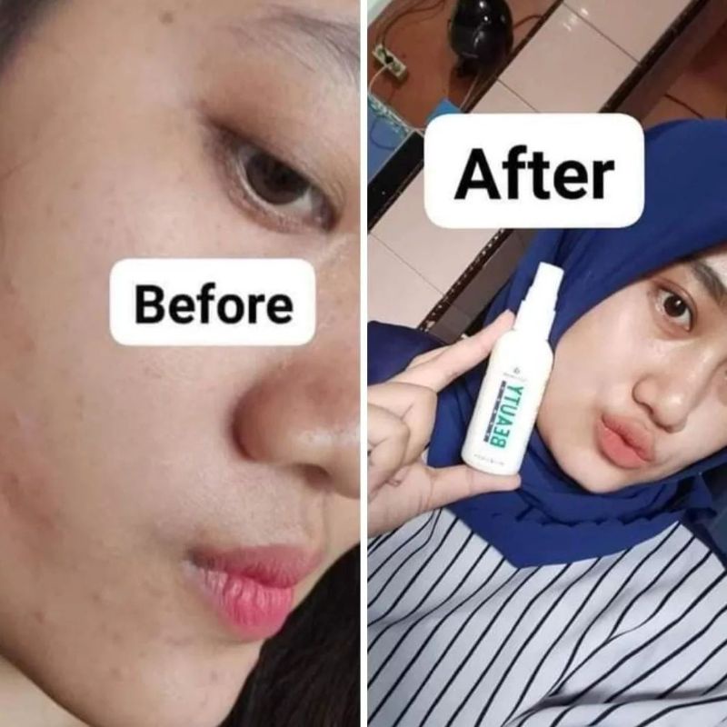 serum natura spray