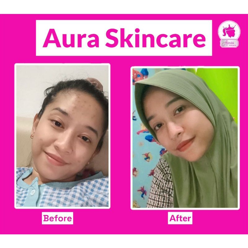 aurascincaresuperwhitening
