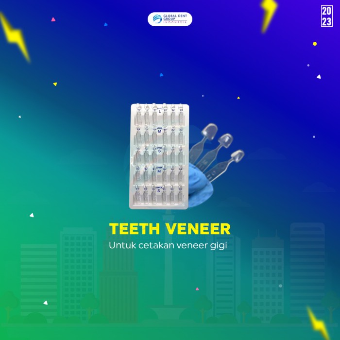 Teeth veneer
