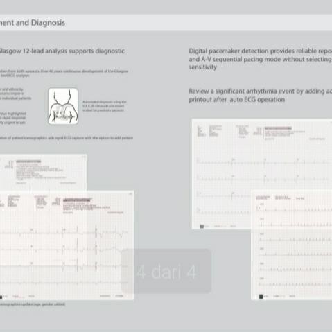 Mindray R12 ECG paper for model R12