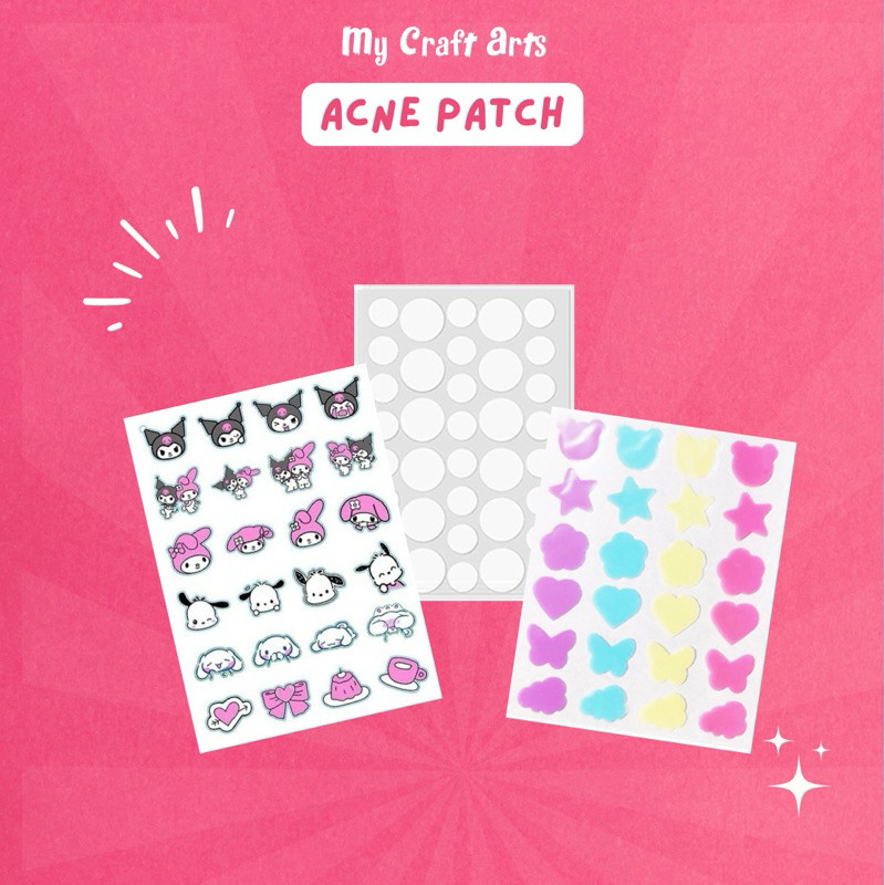 Acne Patch - Pimple Patch - My Craft Arts