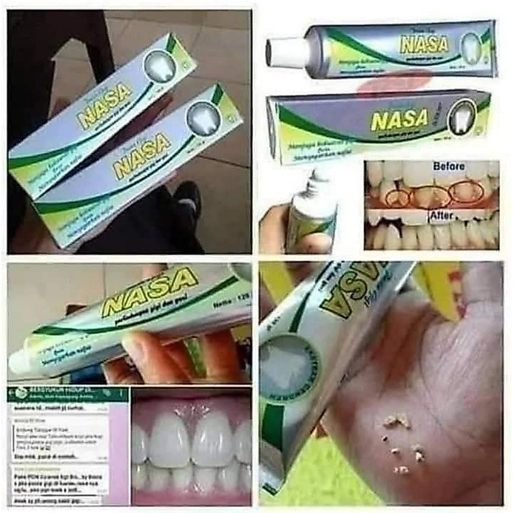 OdolNasa
