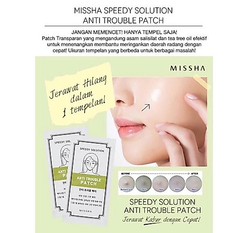 MISSHA Speedy Solution Anti Trouble Patch / Acne Patch Stiker jerawat