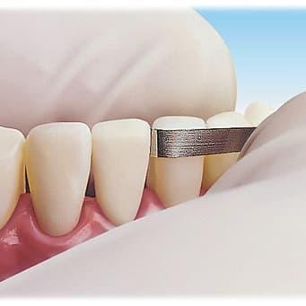 Slicing Ortho 6Mm