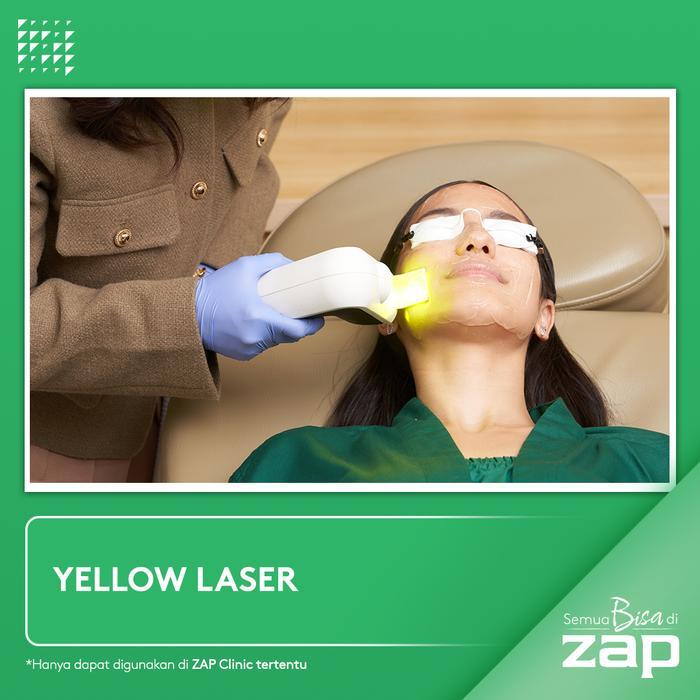 DISKON! Pro Yellow Laser - Z A P