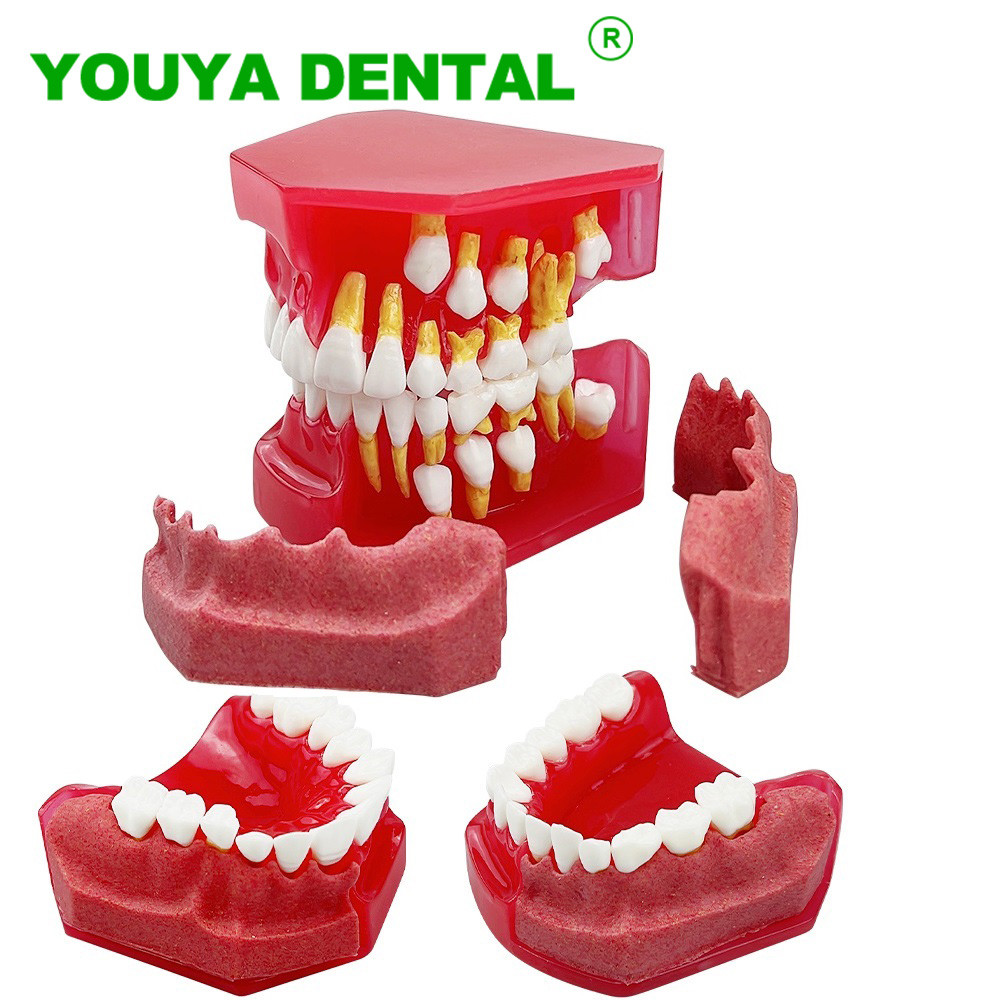Child Dental Model Primary Permanent Teeth Alternate Model Deciduous Replacement Teeth Model For Teaching Study Demonstration